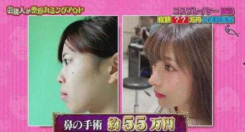 成人偏头怎么整容的视频,偏头痛患者如何通过整形手术重拾完美头型